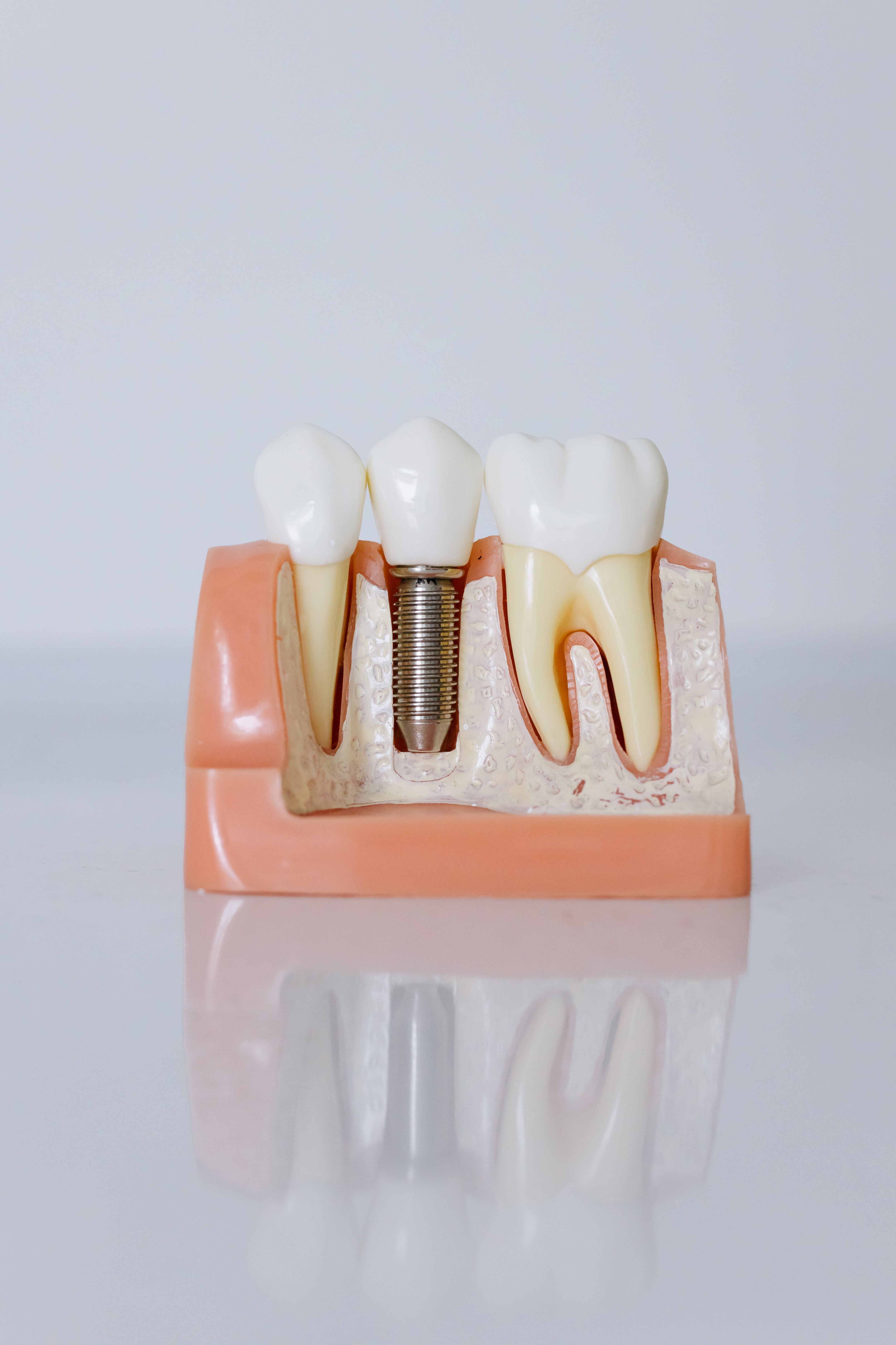 Cirugía oral Dr. Tomás Aguilera Dental Coique